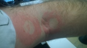 EMGStickOnPadMarks[1]